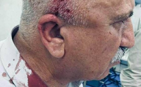 سەرچاوەیەک بۆ نوچە تیڤی: هێرشكرایه‌ سه‌ر فه‌لاح یایچی قایمقامی ناوه‌ندی كه‌ركوك و برینداره‌ 